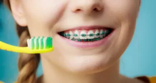 The Rise of Invisible Braces Among Adults