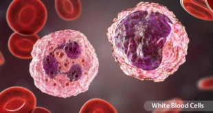 When the Immune System Loses Its Balance: Understanding Lymphocytic Leukemia Beyond the Diagnosis