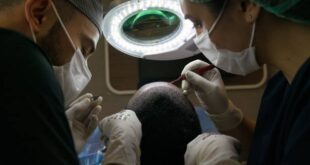 Hair Restoration Guide: Techniques, Costs, Recovery, and Choosing the Best Clinic