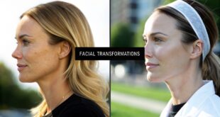 Plastic Surgery Packages Explained: What You Can Expect Before, During, and After Treatment 