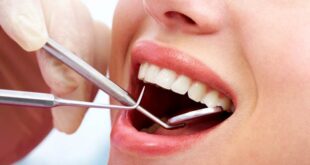 The Consequences of Delaying Essential Dental Care